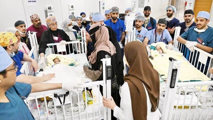 الطفلان بعد فصلهما